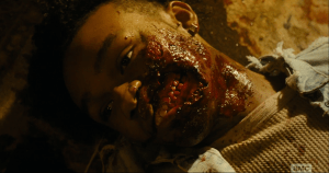 face eaten kid 2