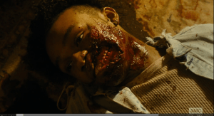 face eaten kid
